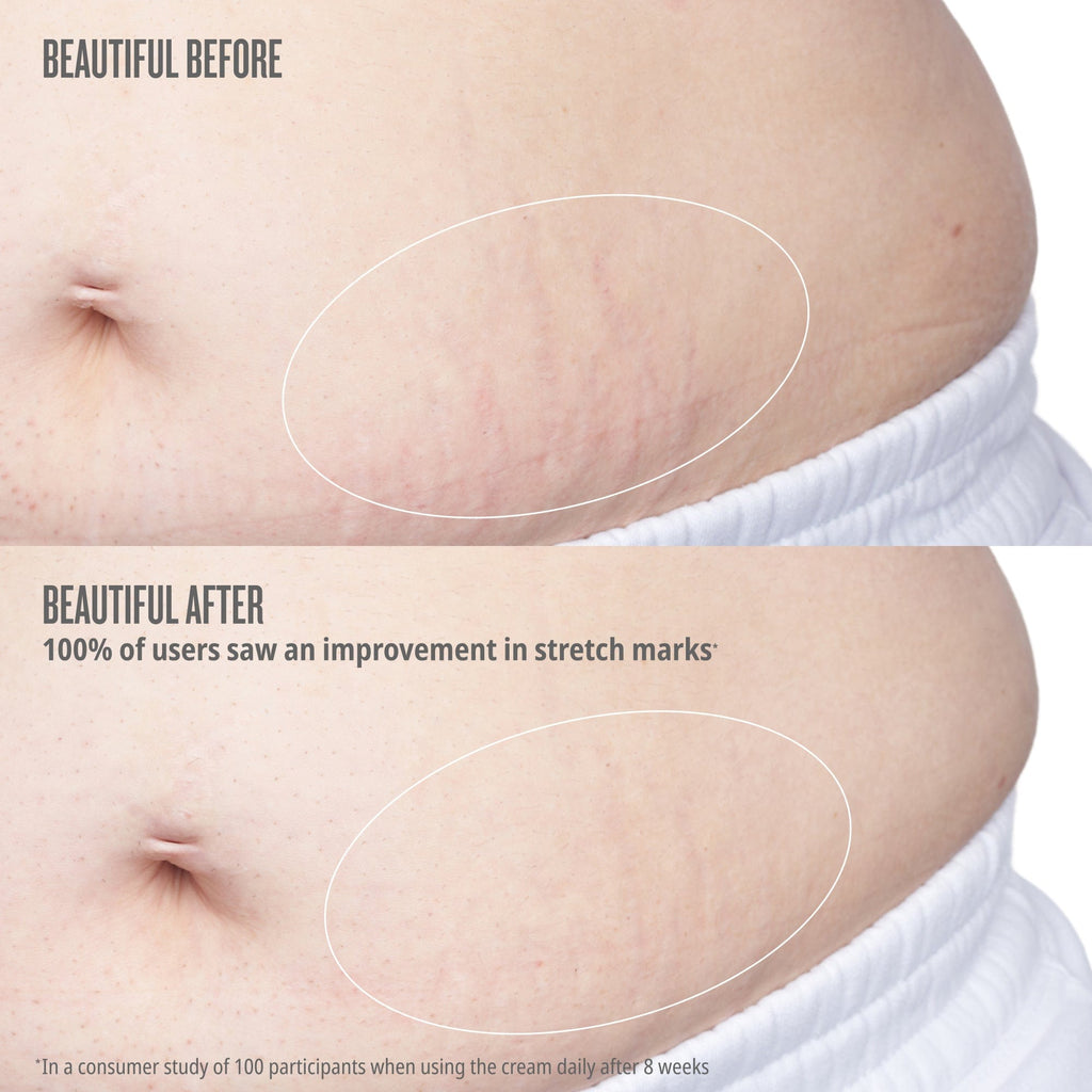 Beija Flor™ Elasti-Body Oil