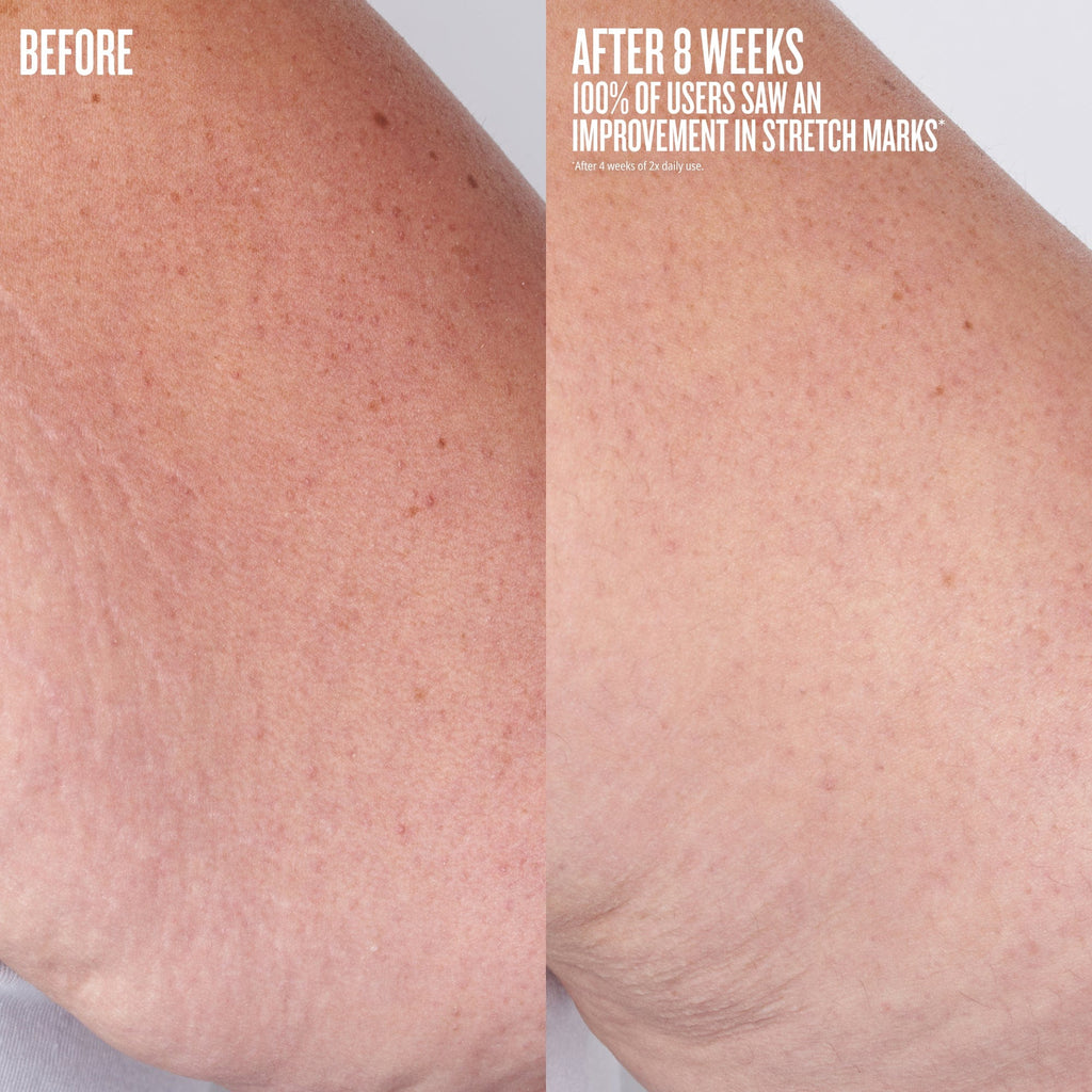 Beija Flor™ Elasti-Body Oil